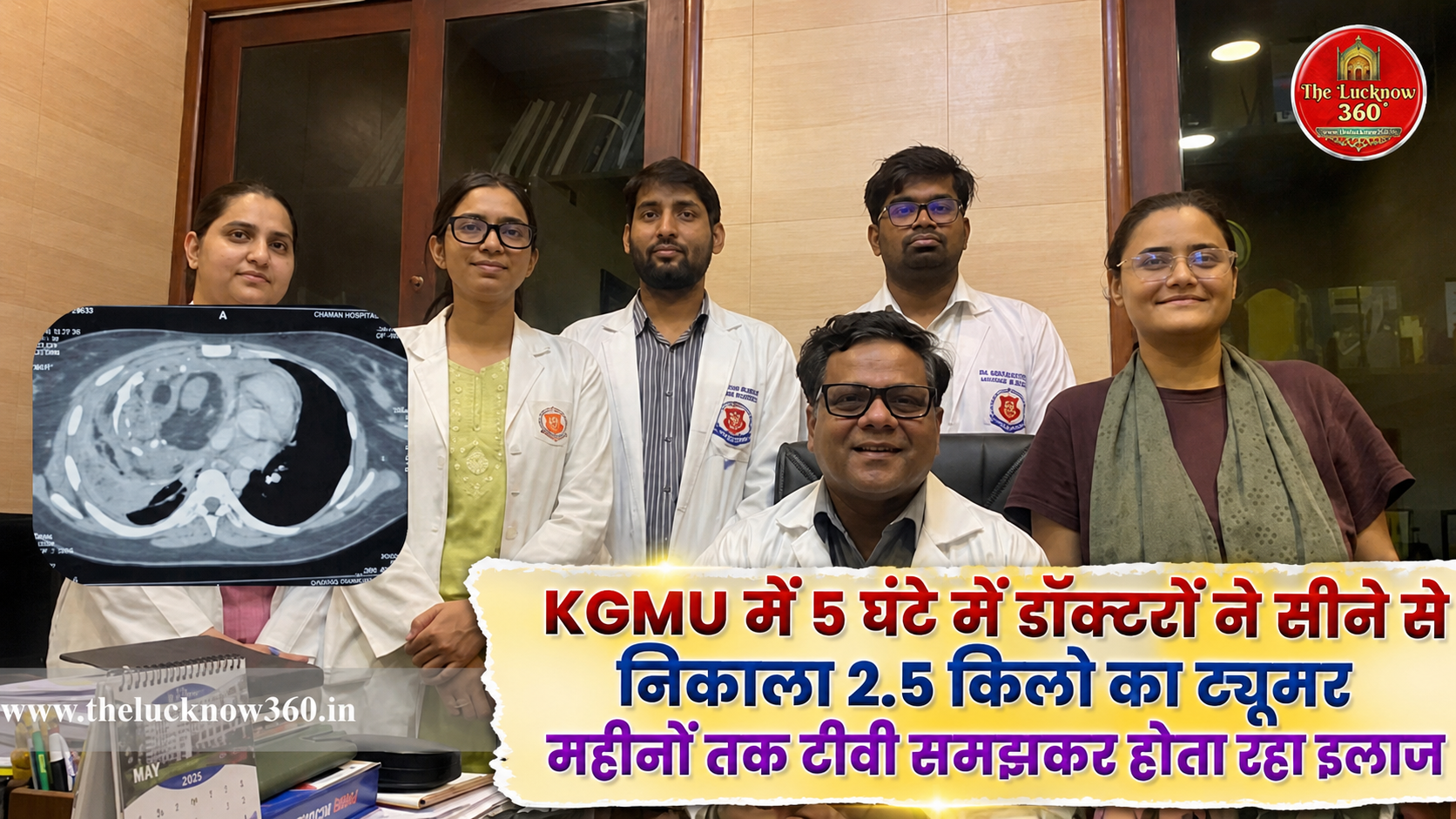 KGMU में डॉक्टरों ने सीने से निकाला 2.5 किलो का ट्यूमर; टीबी समझकर होता रहा गलत इलाज